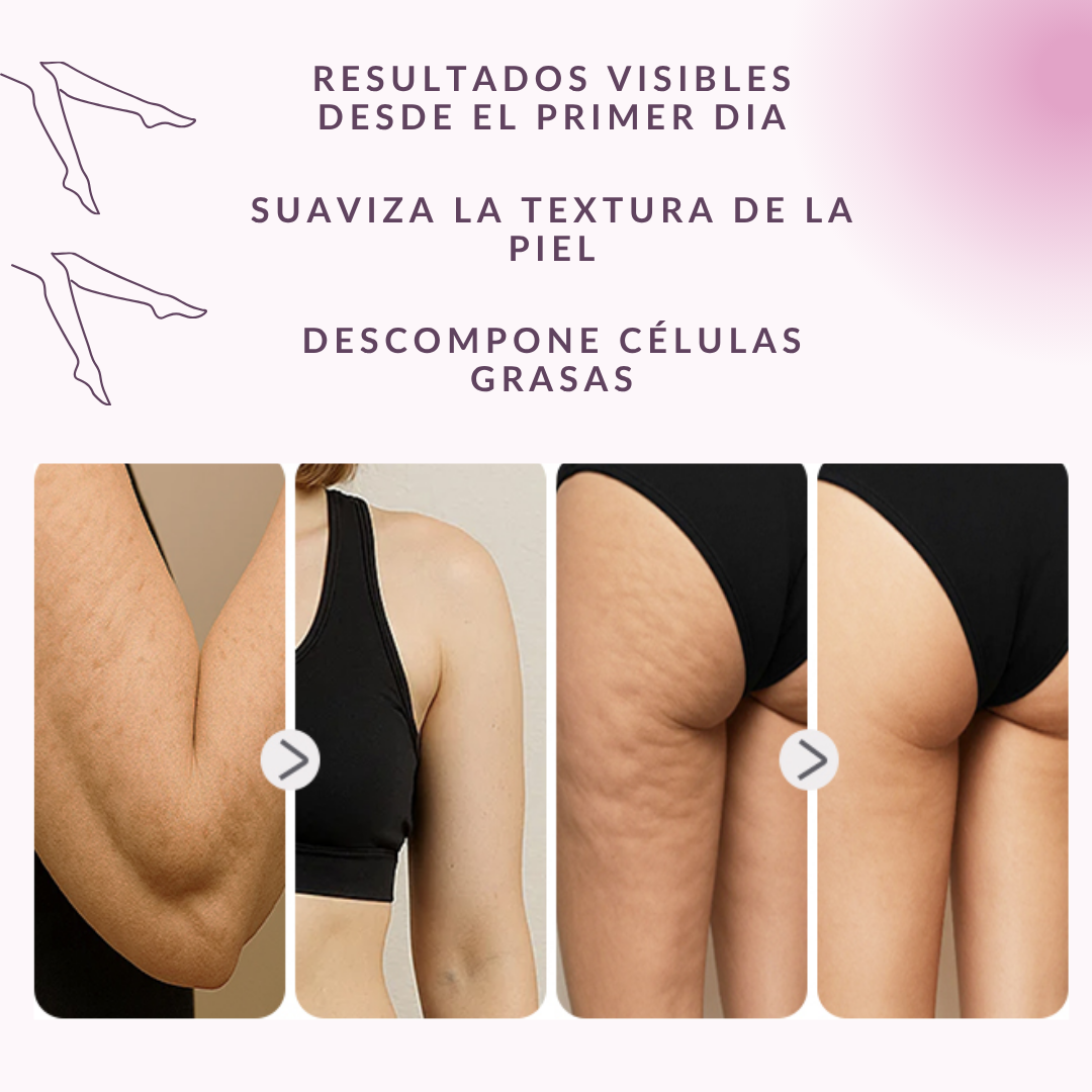 Masajeador Anticelulítico Reafirmante